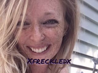 Xfreckledx